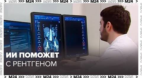 Расшифровку рентген-исследований через ИИ внедрят в поликлиниках Москвы - Москва 24