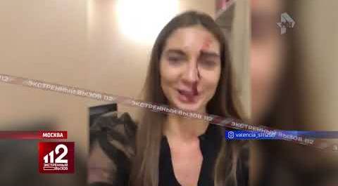 Инстаграм-блогера жестоко избил косметолог | Видео