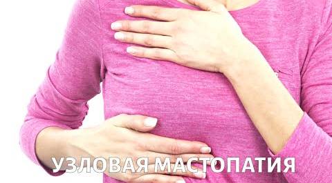 Узловая МАСТОПАТИЯ молочной железы: диагностика и лечение