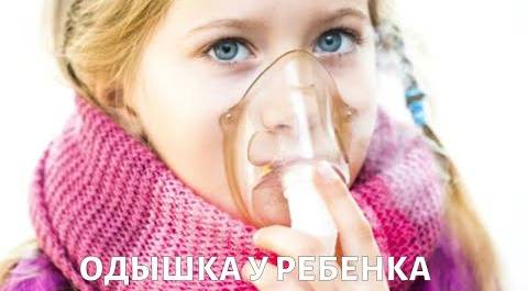 Сильная ОДЫШКА и кашель у ребенка: памятка для родителей