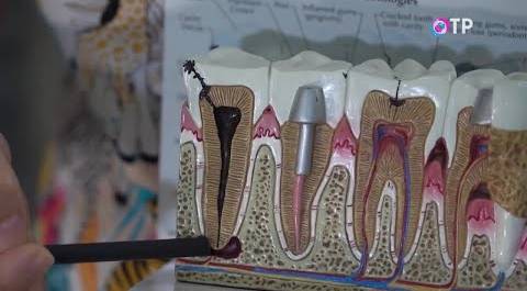 Зубной флюс: чем опасен периостит?